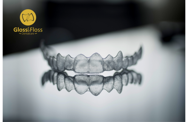 Osynliga tandställningar- invisible aligners for teeth