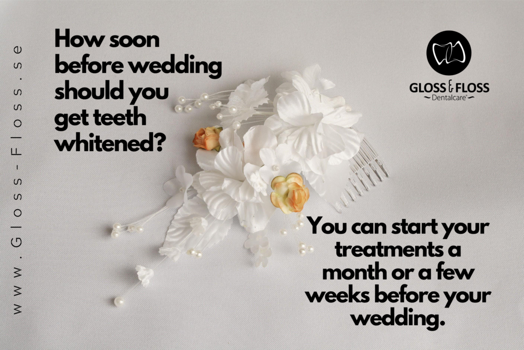 Tooth whitening before wedding?