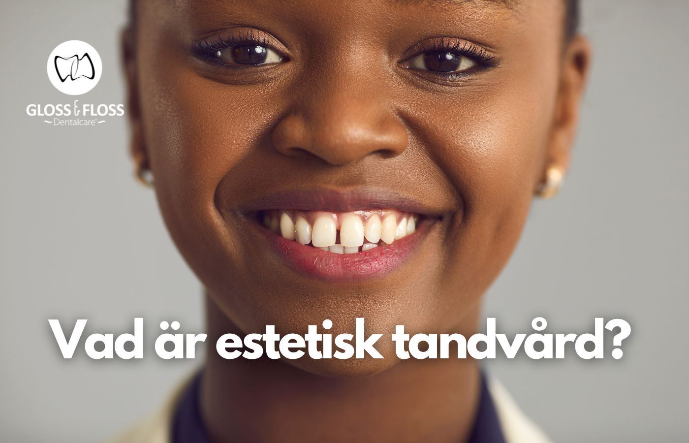 Estetisk tandvård handlar om att förbättra ditt leendes estetik genom olika behandlingar. Det kan innebära allt från enkel färgkorrigering till en fullständig leendeomvandling, även känd som en "smile makeover" eller "Hollywood smile". Ett vackert leende kan ha en positiv inverkan på självförtroende, självkänsla och personliga relationer.

Det finns många olika estetiska behandlingar att välja mellan, så det är viktigt att rådfråga en erfaren tandläkare med expertis inom estetisk tandvård. Kontakta oss på Gloss & Floss Dental Care så vi kan prata mer om dina behöver.