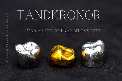 tandkronor behandling guide. Tre tandkronor från Gloss & Floss i olika material (metall och guld) på svart bakgrund