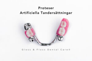 En delprotes i metall med rosa bas och konstgjorda tänder, framtagen för att ersätta saknade tänder.