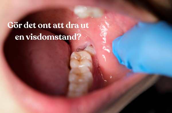 Visdomstandsextraktion hos Gloss & Floss Dental Care i Stockholm – gör det ont att dra ut en visdomstand?